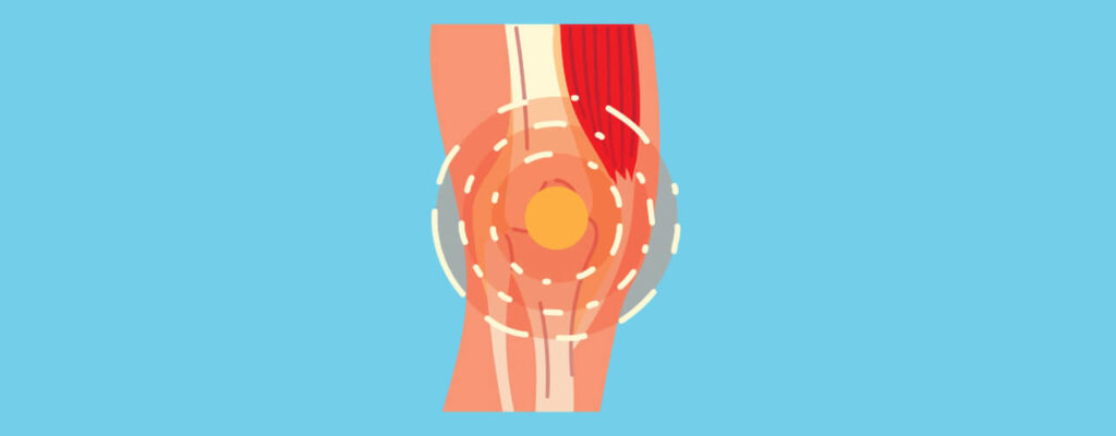 Causes and Treatments of knee pain in CT and NY